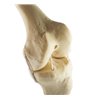 Genunchi stang ORTHObones Standard