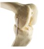 Genunchi stang ORTHObones Standard