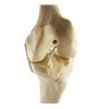 Genunchi stang ORTHObones Standard