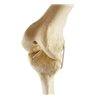 Genunchi stang ORTHObones Standard