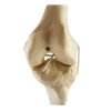 Genunchi stang ORTHObones Standard