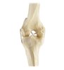 Genunchi stang ORTHObones Standard