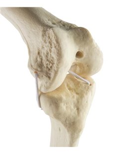 Genunchi drept ORTHObones Standard