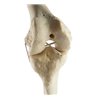 Genunchi drept ORTHObones Standard