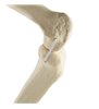 Genunchi drept ORTHObones Standard