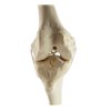 Genunchi drept ORTHObones Standard