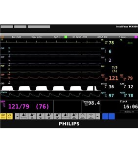 Philips IntelliVue MX800 - Simulare monitor al pacientului pentru Realiti 360
