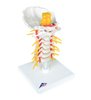 Set de injecție a coloanei vertebrale cervicale