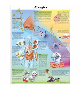 Diagrama de alergii