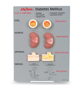 Kit de predare a diabetului zaharat