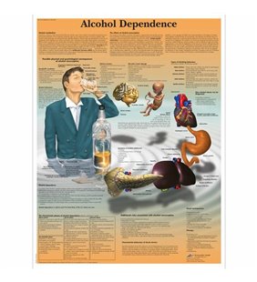 Diagrama - dependență de alcool